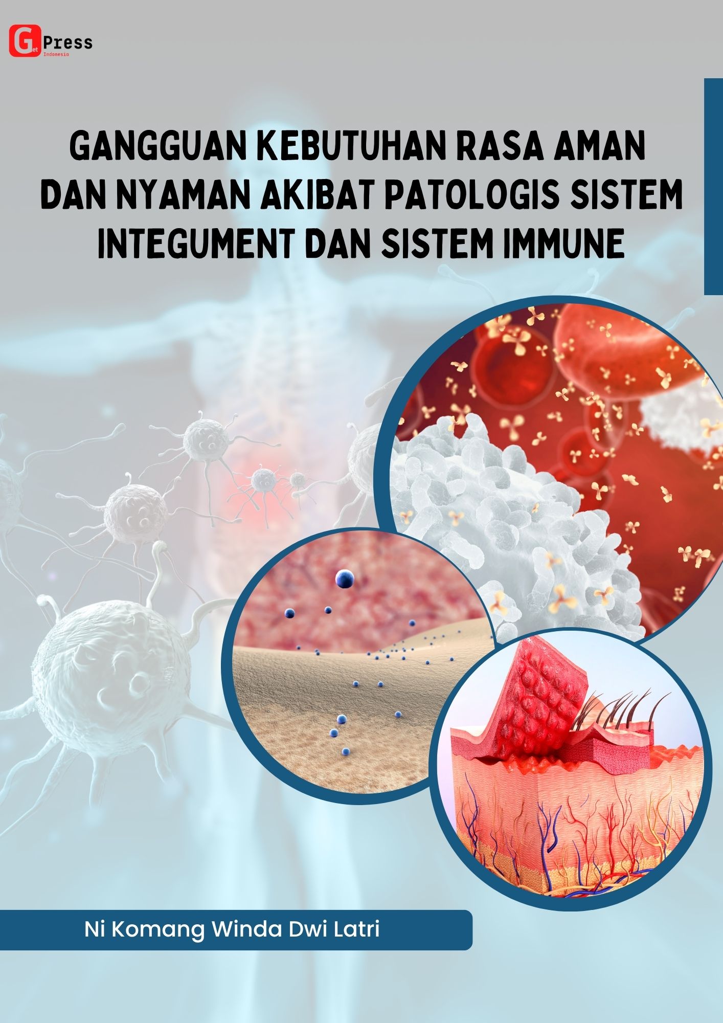 GANGGUAN KEBUTUHAN RASA AMAN DAN NYAMAN AKIBAT PATOLOGIS SISTEM INTEGUMENT DAN SISTEM IMMUNE